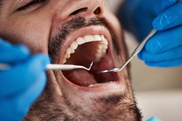 Best Full Mouth Reconstruction  in Bedford, IN